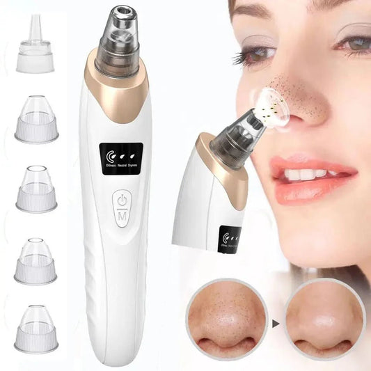 Blackhead Removal Machine - 𝓜𝓞𝓓𝓔𝓡𝓝 𝓑𝓐𝓨𝓣𝓘