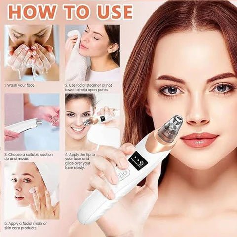 Blackhead Removal Machine - 𝓜𝓞𝓓𝓔𝓡𝓝 𝓑𝓐𝓨𝓣𝓘